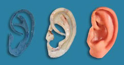 Ear Reconstruction Stages